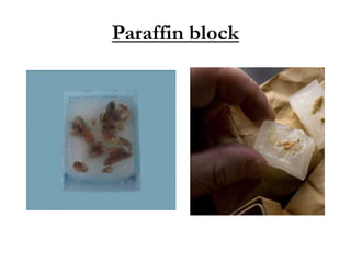 Paraffin block
 