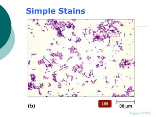Simple Stains
Figure 4.16b
 