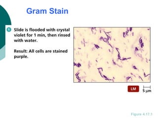 Gram Stain
Figure 4.17.1
 