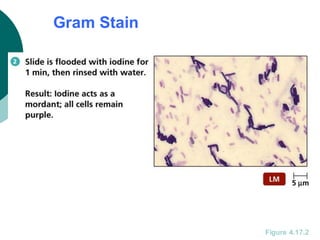 Gram Stain
Figure 4.17.2
 