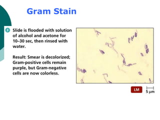 Gram Stain
 
