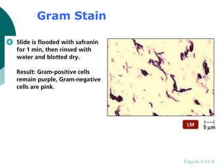 Gram Stain
Figure 4.17.4
 