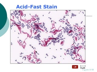 Acid-Fast Stain
Figure 4.18
 