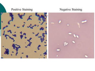 Positive Staining Negative Staining
 