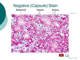 Negative (Capsule) Stain
Figure 4.20
 