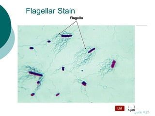 Flagellar Stain
Figure 4.21
 