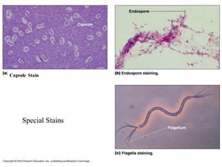 Capsule Stain
Special Stains
 