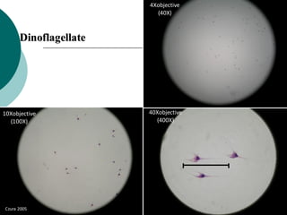 Dinoflagellate
4Xobjective
(40X)
10Xobjective
(100X)
40Xobjective
(400X)
Czura 2005
 