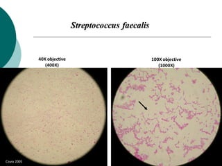 100X objective
(1000X)
40X objective
(400X)
Streptococcus faecalis
Czura 2005
 