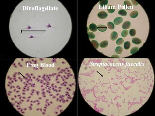 Dinoflagellate
Frog Blood
Lilium Pollen
Streptococcus faecalis
 