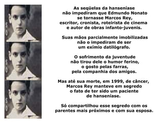 As seqüelas da hanseníase
  não impediram que Edmundo Nonato
         se tornasse Marcos Rey,
 escritor, cronista, roteirista de cinema
    e autor de obras infanto-juvenis.

  Suas mãos parcialmente imobilizadas
        não o impediram de ser
        um exímio datilógrafo.

       O sofrimento da juventude
      não tirou dele o humor ferino,
           o gosto pelas farras,
      pela companhia dos amigos.

 Mas até sua morte, em 1999, de câncer,
    Marcos Rey manteve em segredo
      o fato de ter sido um paciente
              de hanseníase.

  Só compartilhou esse segredo com os
parentes mais próximos e com sua esposa.
 