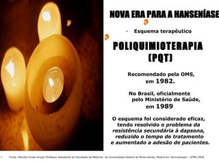 -      Esquema terapêutico


                                                                                    POLIQUIMIOTERAPIA
                                                                                           (PQT)
                                                                                               Recomendado pela OMS,
                                                                                                    em 1982.

                                                                                                 No Brasil, oficialmente
                                                                                                  pelo Ministério de Saúde,
                                                                                                       em 1989

                                                                                  O esquema foi considerado eficaz,
                                                                                     tendo resolvido o problema da
                                                                                   resistência secundária à dapsona,
                                                                                    reduzido o tempo de tratamento
                                                                                  e aumentado a adesão de pacientes.

   Fonte: Marcelo Grossi Araújo Professor Assistente da Faculdade de Medicina da Universidade Federal de Minas Gerais, Mestre em Dermatologia - UFMG (MG)
 