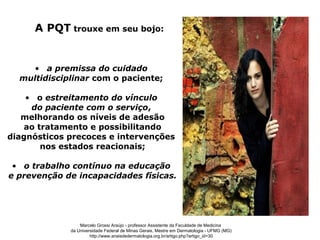 A PQT trouxe em seu bojo:


    • a premissa do cuidado
  multidisciplinar com o paciente;

    • o estreitamento do vínculo
     do paciente com o serviço,
   melhorando os níveis de adesão
   ao tratamento e possibilitando
diagnósticos precoces e intervenções
       nos estados reacionais;

 • o trabalho contínuo na educação
e prevenção de incapacidades físicas.




                 Marcelo Grossi Araújo - professor Assistente da Faculdade de Medicina
             da Universidade Federal de Minas Gerais, Mestre em Dermatologia - UFMG (MG)
                      http://www.anaisdedermatologia.org.br/artigo.php?artigo_id=30
 