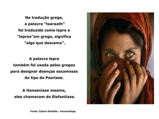 Na tradução grega,
      a palavra “tsaraath”
   foi traduzida como lepra e
   “lepros”em grego, significa
      “algo que descama”.



         A palavra lepra
 também foi usada pelos gregos
para designar doenças escamosas
      do tipo da Psoríase.


     A Hanseníase mesmo,
 eles chamavam de Elefantíase.



         Fonte: Cássio Ghidella - hansenólogo
 