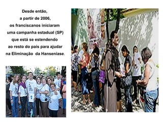 Desde então,
       a partir de 2006,
 os franciscanos iniciaram
uma campanha estadual (SP)
  que está se estendendo
 ao resto do país para ajudar
na Eliminação da Hanseníase.
 