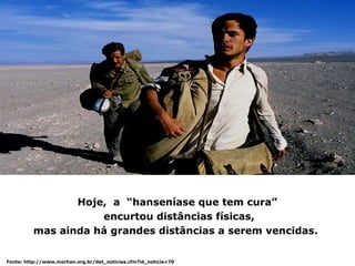 Hoje, a “hanseníase que tem cura”
                    encurtou distâncias físicas,
         mas ainda há grandes distâncias a serem vencidas.

Fonte: http://www.morhan.org.br/det_noticias.cfm?id_noticia=70
 
