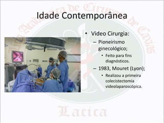 Idade Contemporânea
• Video Cirurgia:
– Pioneirismo
ginecológico;
• Feito para fins
diagnósticos.

– 1983, Mouret (Lyon);
• Realizou a primeira
colecistectomia
videolaparoscópica.

 