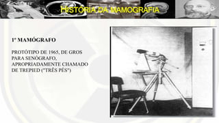HISTÓRIA DA MAMOGRAFIA
1º MAMÓGRAFO
PROTÓTIPO DE 1965, DE GROS
PARA SENÓGRAFO,
APROPRIADAMENTE CHAMADO
DE TREPIED ("TRÊS PÉS")
 