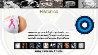 HISTÓRICO
PORQUE IMAGEM É TUDO!
www.imagemradiologica.webnode.com
www.facebook.com/imagemradiologica
contato.imagemradiologica@gmail.com
 