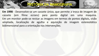Em 1998 - Desenvolve-se um cassete único, que permite a troca de imagem de
cassete (em filme ecrans) para ponto digital em uma maquina.
Em um monitor pode-se revisar as imagens em termos de pontos digitais, visão
ampliada, localização de agulha e aquisição de imagem estereotática
bidimensional para a orientação nas intervenções.
HISTÓRIA DA MAMOGRAFIA
 