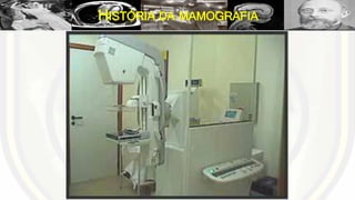 HISTÓRIA DA MAMOGRAFIA
 