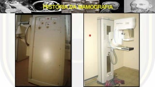 HISTÓRIA DA MAMOGRAFIA
 
