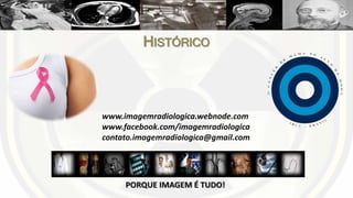 HISTÓRIA DA MAMOGRAFIA