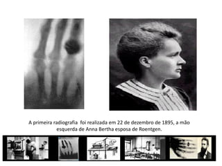 História da radiologia | PDF
