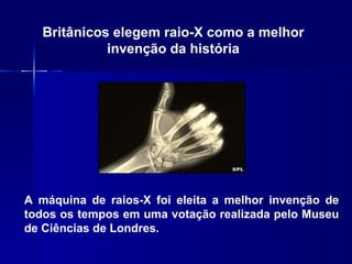 Britânicos elegem raio-X como a melhor
             invenção da história




A máquina de raios-X foi eleita a melhor invenção de
todos os tempos em uma votação realizada pelo Museu
de Ciências de Londres.
 