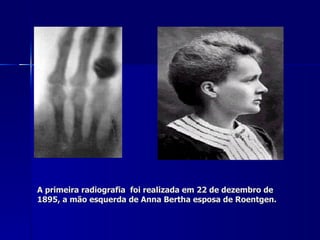 A primeira radiografia foi realizada em 22 de dezembro de
1895, a mão esquerda de Anna Bertha esposa de Roentgen.
 