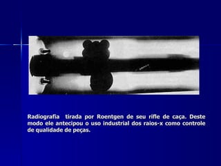 Radiografia tirada por Roentgen de seu rifle de caça. Deste
modo ele antecipou o uso industrial dos raios-x como controle
de qualidade de peças.
 