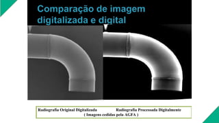 Radiografia Original Digitalizada Radiografia Processada Digitalmente
( Imagens cedidas pela AGFA )
 
