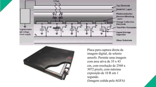 Placa para captura direta da
imagem digital, de selenio
amorfo. Permite uma imagem
com area ativa de 35 x 43
cm, com resolução de 2560 x
3072 pixels, com máxima
exposição de 10 R em 1
segundo.
(Imagem cedida pela AGFA)
 