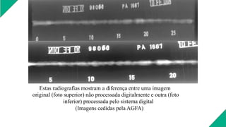 Estas radiografias mostram a diferença entre uma imagem
original (foto superior) não processada digitalmente e outra (foto
inferior) processada pelo sistema digital
(Imagens cedidas pela AGFA)
 