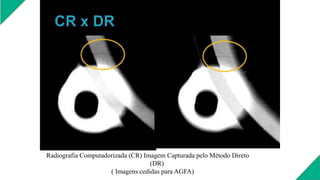 Radiografia Computadorizada (CR) Imagem Capturada pelo Método Direto
(DR)
( Imagens cedidas para AGFA)
 