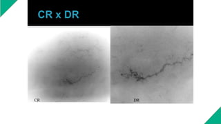 CR DR
 