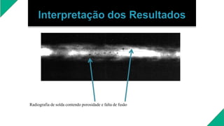 Radiografia de solda contendo porosidade e falta de fusão
 