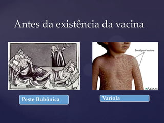 Antes da existência da vacina

{
Peste Bubônica

Varíola

 