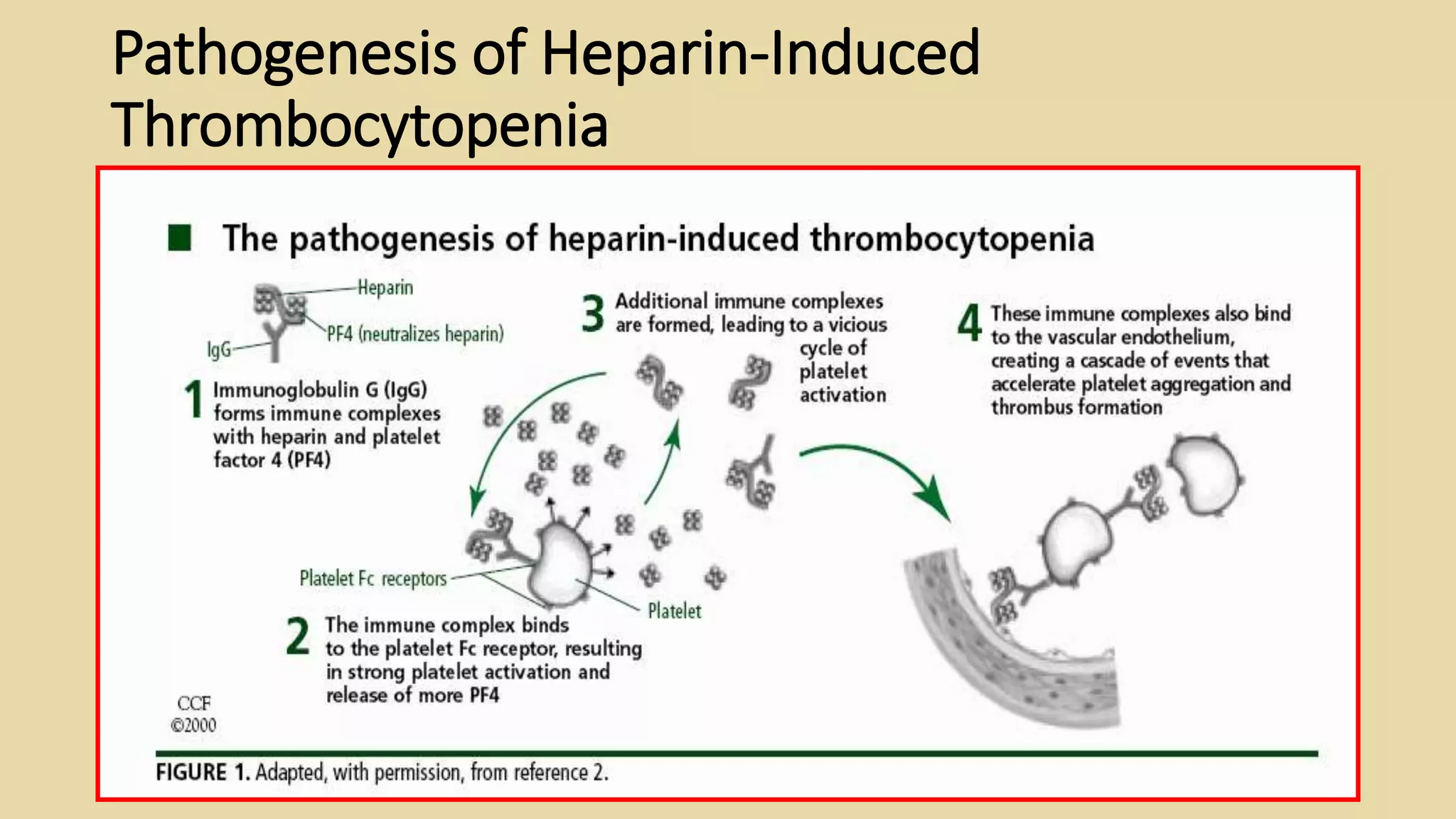 Hit Drop Heparin Induced Thrombocytopeia (HIT) | PPTX
