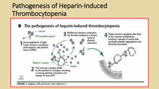 Pathogenesis of Heparin-Induced
Thrombocytopenia
 