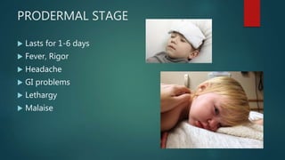 PRODERMAL STAGE
 Lasts for 1-6 days
 Fever, Rigor
 Headache
 GI problems
 Lethargy
 Malaise
 