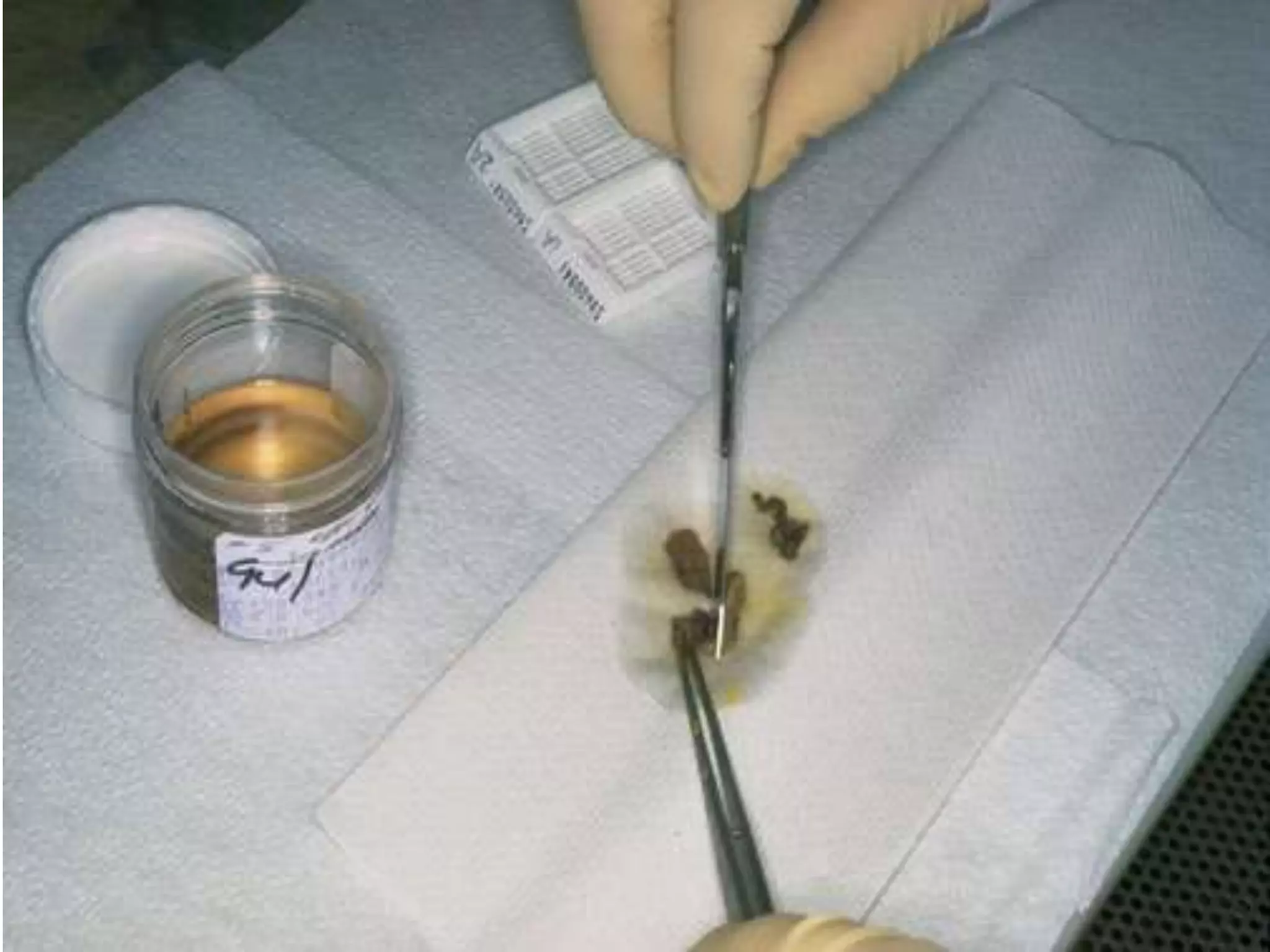 Fixatives used in histopathology