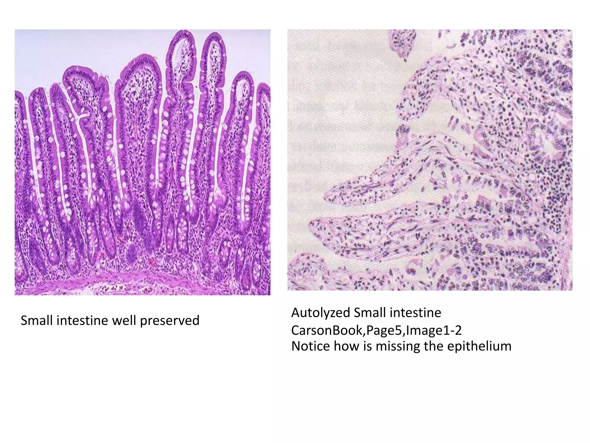 Fixatives used in histopathology