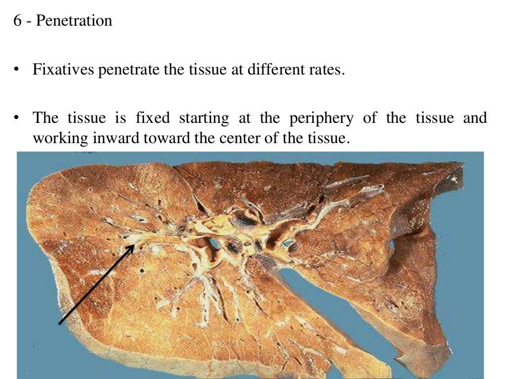 Fixatives used in histopathology