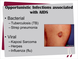 Opportunistic Infections associated with AIDS Bacterial Tuberculosis (TB) Strep pneumonia Viral Kaposi Sarcoma Herpes Influenza (flu) 