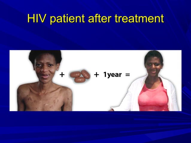 Hiv | PPT | Infectious Diseases | Diseases and Conditions
