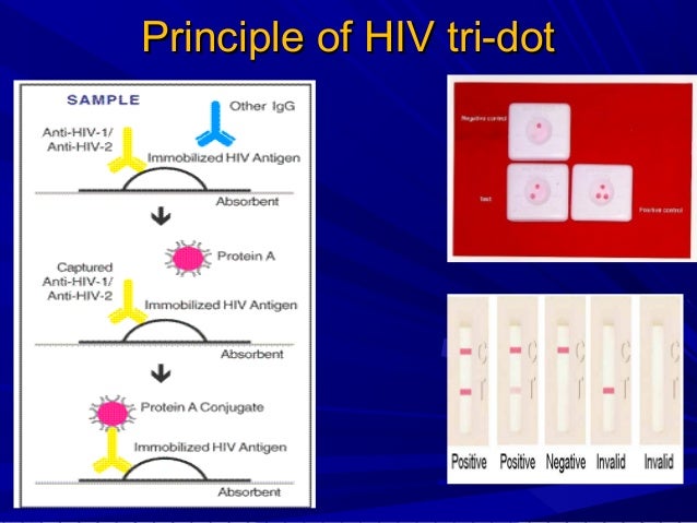 dot blot assay principle dot blot assay principle