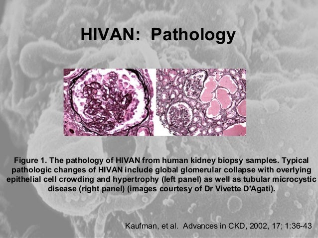 Disorders of the Kidney in HIV Infection