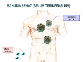 MANUSIA SEHAT (BELUM TERINFEKSI HIV)

                                     Sel Imun
                                      CD 4




Infeksi
Kelamin
 