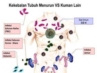 Kekebalan Tubuh Menurun VS Kuman Lain


                                        Sel Imun
                                         CD 4
 Infeksi
 Saluran Nafas
 (TBC)


 Infeksi Saluran
 Cerna - Diare

                                            Infeksi
Infeksi                                     Jamur
Kelamin
 